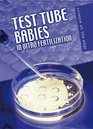 Test Tube Babies In Vitro Fertilization