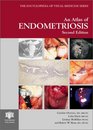 An Atlas of Endometriosis Second Edition