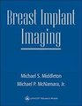 Breast Implant Imaging