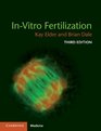 InVitro Fertilization