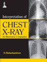 Interpretation of Chest Xray An Illustrated Companion