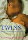 Twins From Conception to Birth