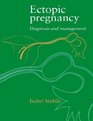 Ectopic Pregnancy  Diagnosis and Management