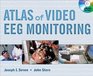 The Atlas of VideoEEG Monitoring