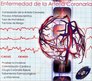 Enfermedad de La Arteria Coronaria