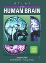 Atlas of the Human Brain Deluxe Edition
