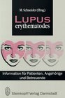 Lupus Erythematoles Information Fur Patienten Angehorige Und Betreuende