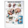 Anatomy of the Brain 3D Raised Relief Chart