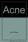 Acne Morphogenesis and treatment