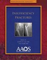 Insufficiency Fractures