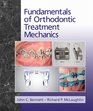 Fundamentals of Orthodontic Treatment Mechanics