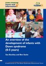 An Overview of the Development of Infants with Down Syndrome  Overview Pt 1