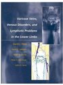 Varicose Veins Venous Disorders and Lymphatic Problems in the Lower Limbs