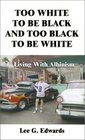 Too White to Be Black and Too Black to Be White: Living With Albinism