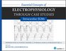 Essential Concepts of Electrophysiology through Case Studies Intracardiac EGMs
