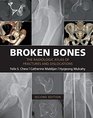 Broken Bones The Radiologic Atlas of Fractures and Dislocations