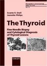 The Thyroid FineNeedle Biopsy and Cytological Diagnosis of Thyroid Lesions