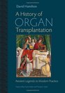 A History of Organ Transplantation Ancient Legends to Modern Practice