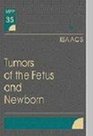 Tumors of the Fetus and Newborn