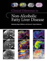 Clinical Dilemmas in NonAlcoholic Fatty Liver Disease