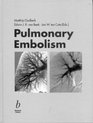 Pulmonary Embolism Epidemiology Diagnosis and Treatment