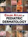 Color Atlas Pediatric Dermatology