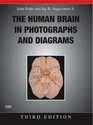 The Human Brain in Photographs and Diagrams with CDROM