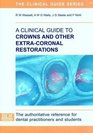 A Clinical Guide to Crowns and Other Extracoronal Restorations