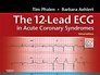 12Lead ECG in Acute Coronary Syndromes Pocket Reference for the 12Lead ECG in Acute Coronary Syndromes