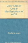 Color Atlas of Ocular Manifestations of AIDS Diagnosis and Management