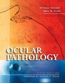 Ocular Pathology