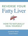 Reverse Your Fatty Liver: How To Naturally Heal Yourself