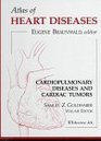 Cardiopulmonary Diseases and Cardiac Tumors