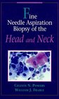 Fine Needle Aspiration Biopsy of the Head and Neck