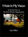 The Hole in My Vision