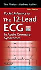 Pocket Reference for The 12Lead ECG in Acute Coronary Syndromes