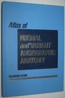 Atlas of Normal and Variant Angiographic Anatomy