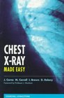 Chest XRay Made Easy