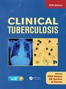 Clinical Tuberculosis 5E