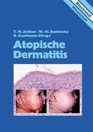 Atopische Dermatitis