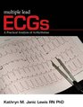 Multiple Lead ECGs A Practical Analysis of Arrhythmias