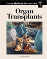 Great Medical Discoveries  Organ Transplants