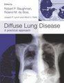 Diffuse Lung Disease: A Practical Approach (Hodder Arnold Publication)
