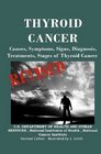 Thyroid Cancer Causes Symptoms Signs Diagnosis Treatments Stages Of Thyroid Cancer