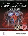 Illustrated Guide to Cardiovascular Disease