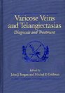 Varicose Veins and Telangiectasias Diagnosis and Treatment