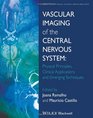Vascular Imaging of the Central Nervous System Physical Principles Clinical Applications and Emerging Techniques