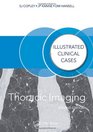 Thoracic Imaging Second Edition