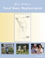 Your Guide to Total Knee Replacement