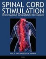 Spinal Cord Stimulation Implantation Percutaneous Implantation Techniques